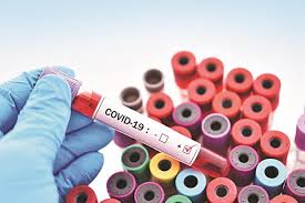 covid-19 virus image for nationxnews coronavirus update